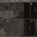 Detailsbilder 2D- / 3D-Röntgensystems Axeos