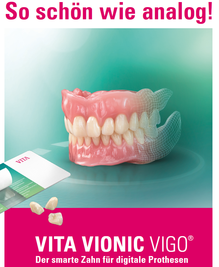 VITA VIONIC VIGO ist eine vollkommen neue Zahngeneration aus SEPolymer mit einem für die digitale Prothesenfertigung perfektionierten Zahndesign.