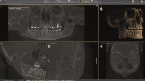 Dentsply SIRONA AXEOS  2D / 3D Röntgenaufnahmen