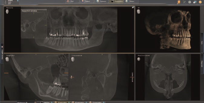 Detailsbilder 2D- / 3D-Röntgensystems Axeos